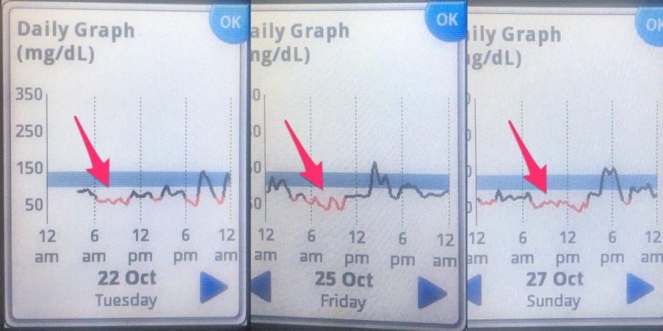 zoe morning low blood sugar skitch