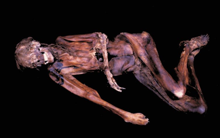 <span class="caption">Pazyryk male mummy with preserved hair and shoulder tattoos.</span> <span class="attribution"><span class="source">© V L Molodin</span></span>