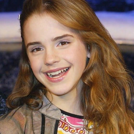 <p><strong>Emma Watson<br></strong><br><strong>Antes</strong>. Cuando era niña sus afilados colmillos sobresalían en su sonrisa. / Foto: Instagram <a rel="nofollow noopener" href="https://www.instagram.com/victoria.weasley/" target="_blank" data-ylk="slk:victoria.weasley;elm:context_link;itc:0;sec:content-canvas" class="link ">victoria.weasley</a> </p>