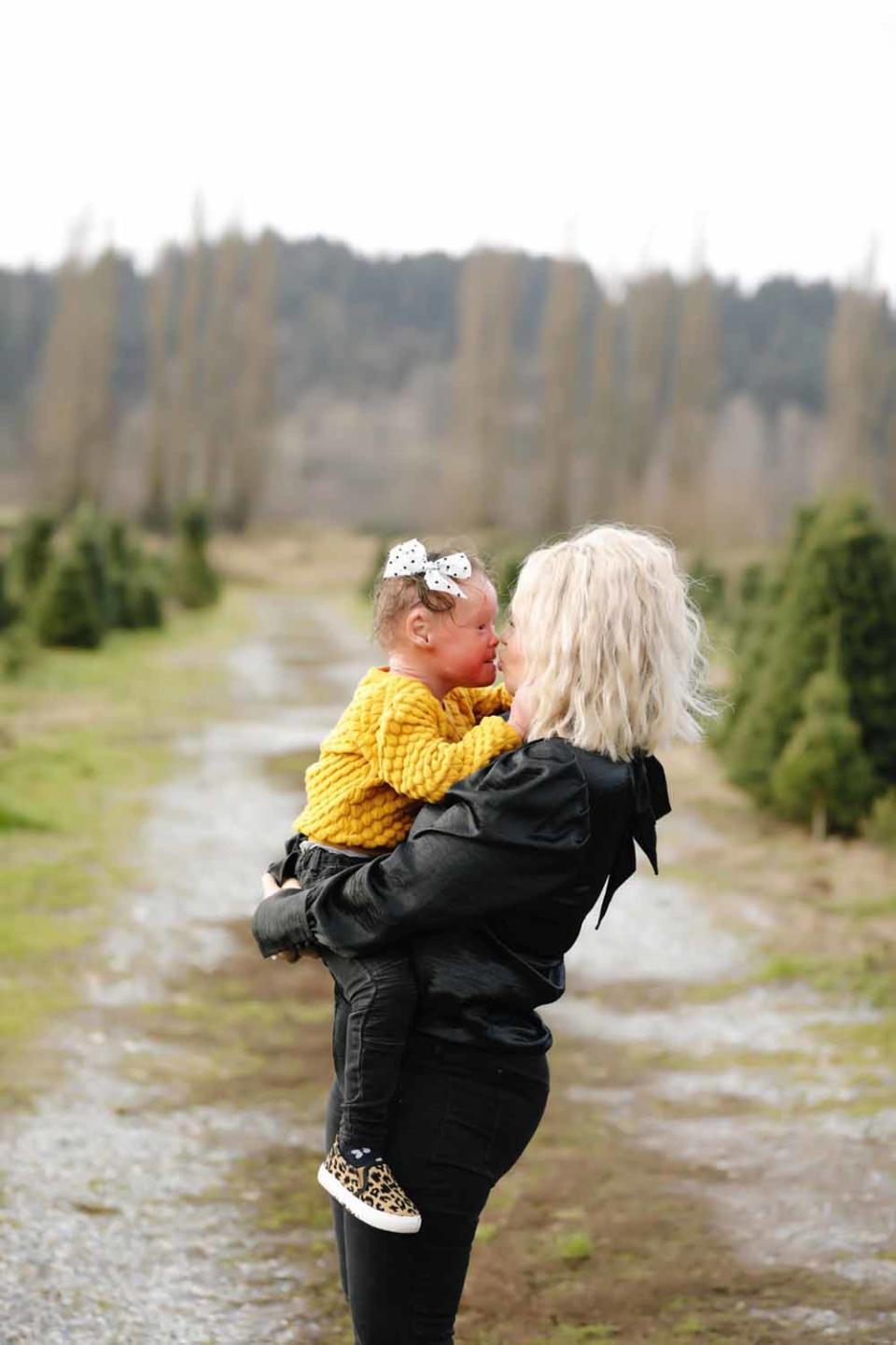 Angie says her daughter’s milestones feel like a miracle. (Collect/PA Real Life)