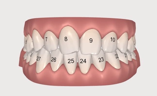 Photo credit: Invisalign scan