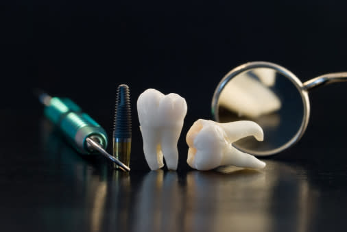 Si tienes restauraciones dentales, visita cada 6 meses el consultorio dental / Foto: Thikstock