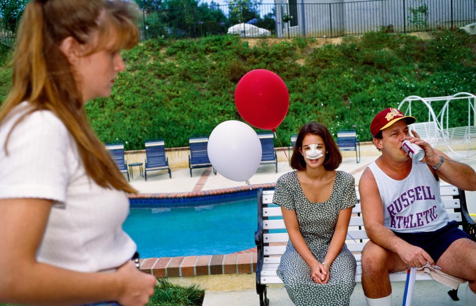 <p>Lindsey, una joven de 18 años, en una fiesta del 4 de julio, tres días después de haberse sometido a una rinoplastia, en Calabasas, California, 1993. Cinco de sus mejores amigas del Instituto de Calabasas ya se habían realizado una cirugía plástica. (© 2017 Lauren Greenfield/INSTITUTE) </p>