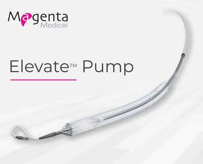 Image of the Magenta Elevate™ Pump, the smallest and most powerful pLVAD.