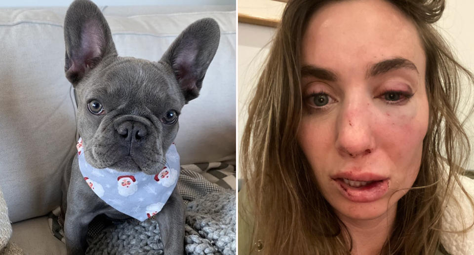 Chloe the French bulldog puppy (left) was stolen after her owner (right) was punched in the face by masked men