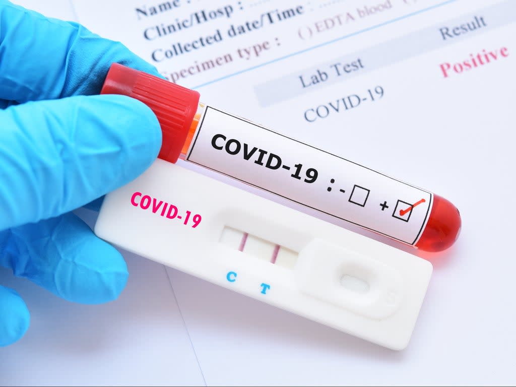 ‘There has been a noticeable change of tune from WHO, which has been accused of acquiescing to Beijing in the past over the coronavirus origin’  (Shutterstock / Jarun Ontakrai)