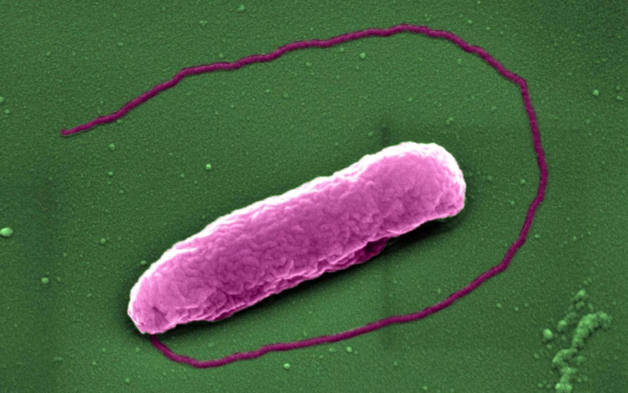 Undated handout issued by Imperial College London showing the superbug Pseudomonas aeruginosa, which can cause lung infections in people on ventilators in Intensive Care Units - Imperial College London/PA