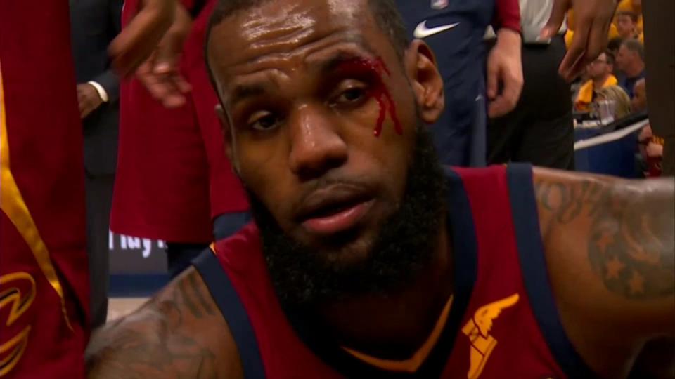 LeBron James comes up bloody. (Screencap via NBA)