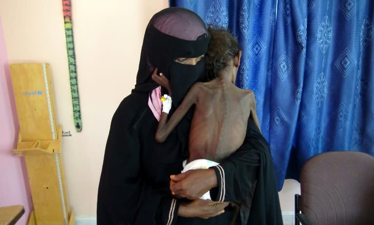 The war in Yemen has pushed 14 million people to the brink of famine