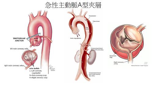 施俊哲醫師提醒，心臟問題的徵兆絕對不能忽視。（圖／臺北市立萬芳醫院提供）