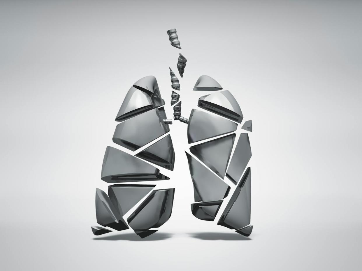 Iron carries oxygen throughout the body, but ironically, it can also make it harder to breathe for people with asthma. <a href="https://www.gettyimages.com/detail/photo/broken-metal-lung-royalty-free-image/1006988894" rel="nofollow noopener" target="_blank" data-ylk="slk:Hiroshi Watanabe/Stone via Getty Images;elm:context_link;itc:0;sec:content-canvas" class="link ">Hiroshi Watanabe/Stone via Getty Images</a>