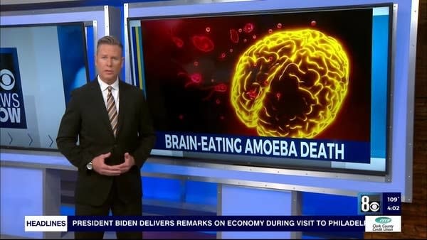 "Brain-eating amoeba death"