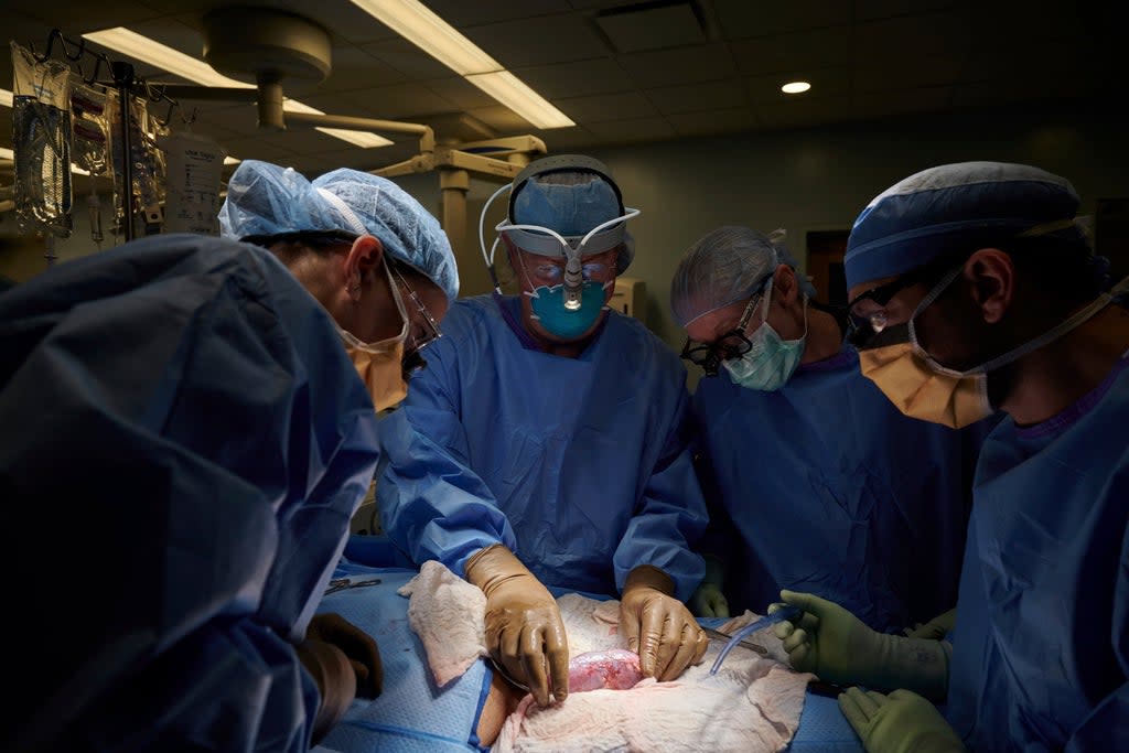 In this September 2021 photo provided by NYU Langone Health, a surgical team at the hospital in New York examines a pig kidney attached to the body of a deceased recipient for any signs of rejection (AP)