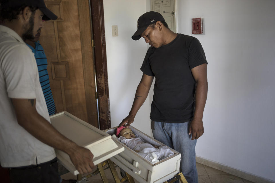 Fernando Gonzalez touches the head of his daughter Anabella as he looks at her body one last time in Maracaibo, Venezuela, Nov. 27, 2019. Gonzalez said doctors told him his 11-month-old died of malnutrition, however, "Sepsis. Central nervous system infection" was written on her death certificate. The father said he was thankful his boss at the cemetery donated his daughter's wake and cremation services, because he didn't have the money for a funeral. (AP Photo/Rodrigo Abd)