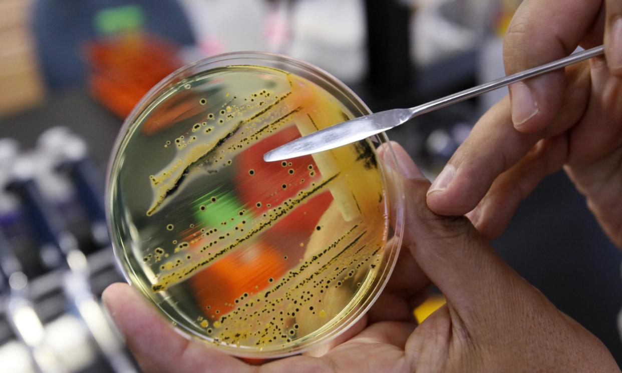 <span>Nearly 1,500 people in England were admitted to hospital for a salmonella infection between April 2022 and March 2023.</span><span>Photograph: Elaine Thompson/AP</span>