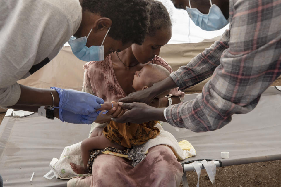 FILE - In this Saturday, Dec. 5, 2020 file photo, a Tigray woman who fled the conflict in Ethiopia's Tigray region, holds her malnourished and severely dehydrated baby as nurses give him IV fluids, at the Medecins Sans Frontieres (MSF) clinic, at Umm Rakouba refugee camp in Qadarif, eastern Sudan. Life for civilians in Ethiopia's embattled Tigray region has become "extremely alarming" as hunger grows and fighting remains an obstacle to reaching millions of people with aid, the United Nations said in a new report released late Thursday, Feb. 4, 2021. (AP Photo/Nariman El-Mofty, File)