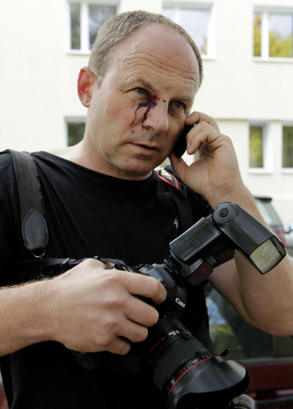 The Associated Press photographer Sergei Grits speaks on the phone, with injuries seen on his face after he was released in Minsk, Tuesday, Sept. 18, 2012. Grits was beaten and briefly detained by plainclothes security officers in the Belarusian capital. Sergei Grits says he was among eight journalists covering a protest by four opposition activists calling for a boycott of this weekend's parliamentary elections when plainclothes security officers attacked them in downtown Minsk. (AP Photo/Vasily Fedosenko, pool)