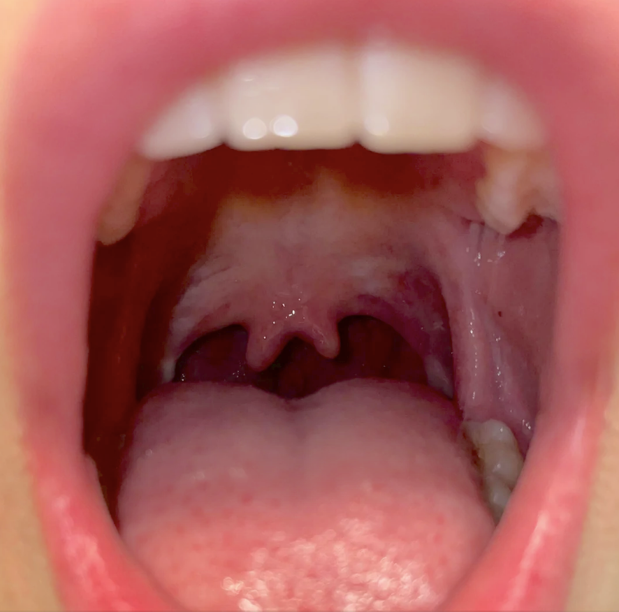 Open mouth showing details of teeth, tongue, and throat