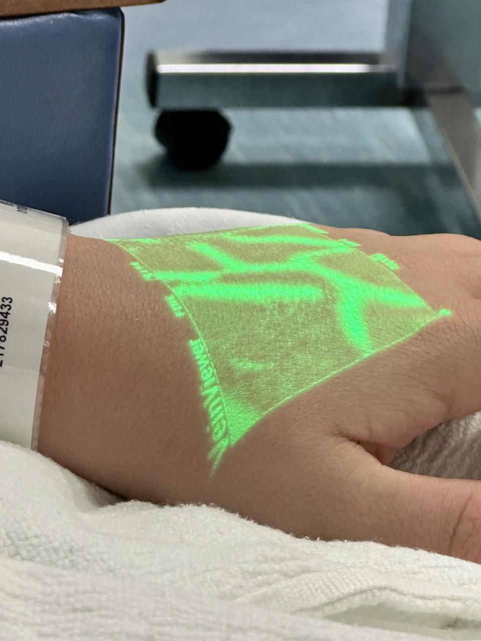 A person's hand veins highlighted in neon green