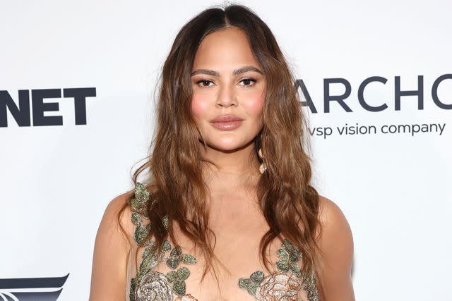 <p>Jamie McCarthy/Getty</p> Chrissy Teigen poses for photos at the 2024 ACE Awards