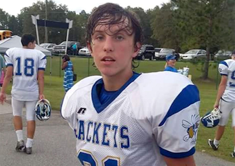 Ryan Parrish, 16, who was hospitalised after an asp or puss caterpillar touched him. Source: Caters