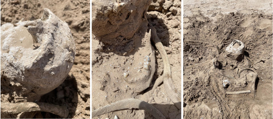 These photos of Saturday, May 7, 2022, provided by Lindsey Melvin of Henderson, Nev., shows human remains she and her sister discovered on a sandbar that recently surfaced as Lake Mead recedes. A closer look revealed a human jaw with teeth.  / Credit: Lindsey Melvin / AP