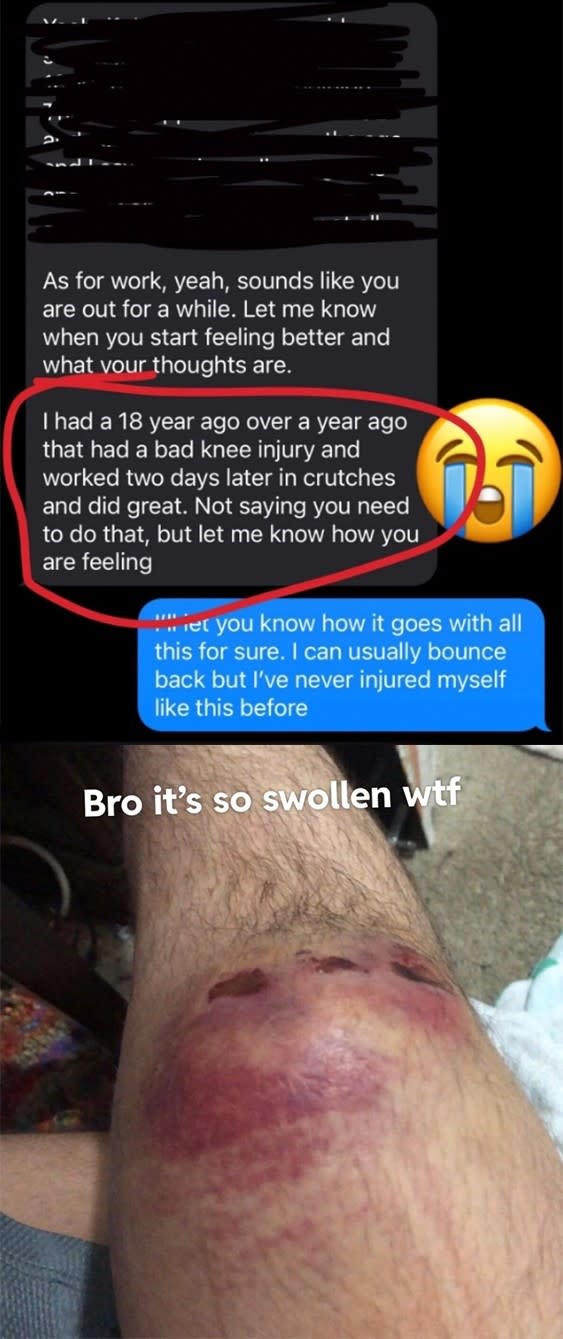 A text message conversation discussing a knee injury and using crutches, with an image of a swollen, bruised knee shown below. Text also reads, 