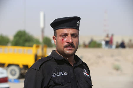 A wounded Iraqi policeman is seen during a protest at the main entrance to the giant Zubair oilfield near Basra, Iraq July 17, 2018. REUTERS/Essam al-Sudani