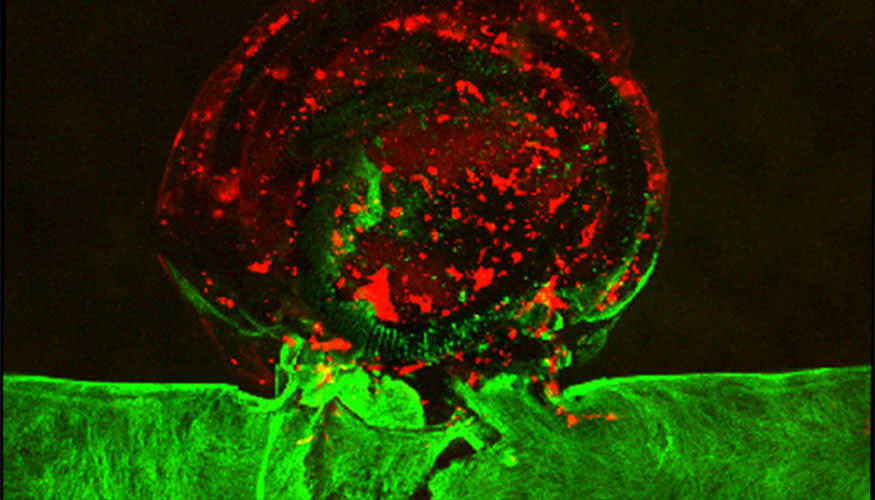 The artificial aneurysm was created using a 3D printer and human cells (LLNL)