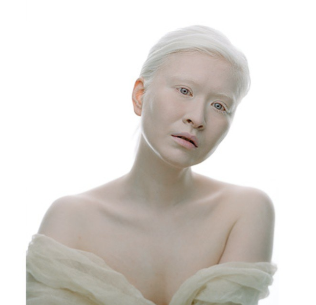 Ces mannequins albinos ne se laissent pas influencer par les critères de beauté traditionnels