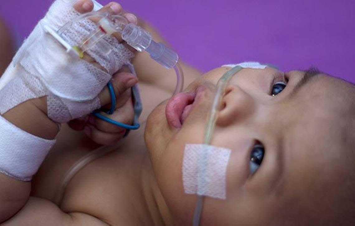 Hospitals across the country are seeing more cases of infants with RSV, or respiratory syncytial virus, who need hydration or oxygen therapy.