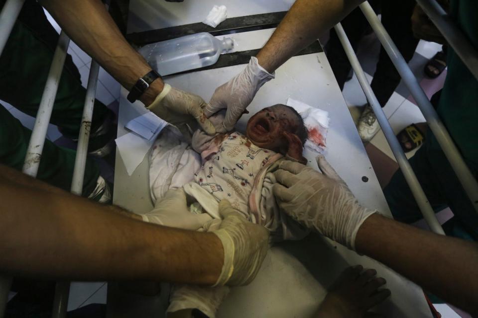 A wounded baby receives care at al-Shifa (Associated Press)