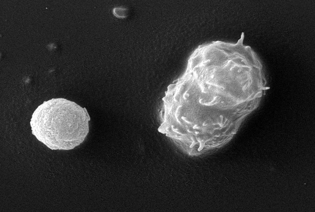 Sur cette image obtenue par microscopie électronique à balayage (MEB), on peut voir deux amibes (Acanthamoeba polyphaga). L'amibe de droite est au stade de trophozoïte, capable de se déplacer. L'amibe de gauche est au stade kystique : entourée d’une paroi qui la protège, elle est en dormance. <a href="https://phil.cdc.gov/Details.aspx?pid=11900" rel="nofollow noopener" target="_blank" data-ylk="slk:CDC/ Catherine Armbruster; Margaret Williams;elm:context_link;itc:0;sec:content-canvas" class="link ">CDC/ Catherine Armbruster; Margaret Williams</a>