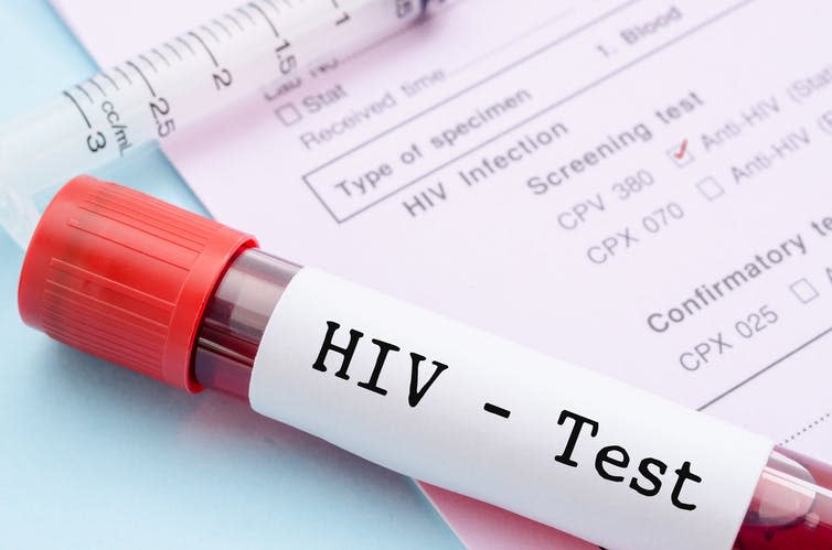 <span class="caption">Thanks to antiretrovirals HIV is no longer a death sentence for most people.</span> <span class="attribution"><a class="link " href="https://www.shutterstock.com/image-photo/sample-blood-collection-tube-hiv-test-304165361" rel="nofollow noopener" target="_blank" data-ylk="slk:Room's studio/Shutterstock;elm:context_link;itc:0;sec:content-canvas">Room's studio/Shutterstock</a></span>