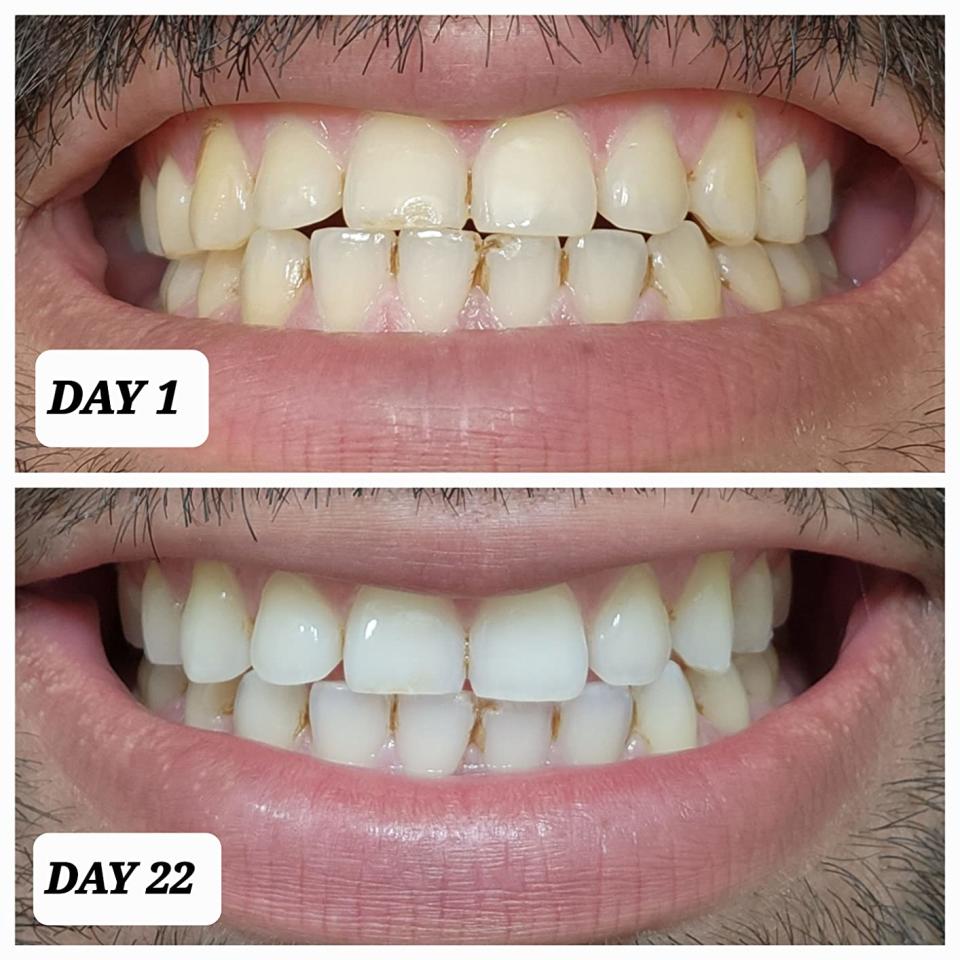 Crest 3D Whitestrips 