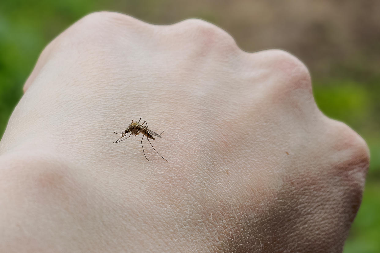 Picadura de mosquitos en la piel, primer plano. 