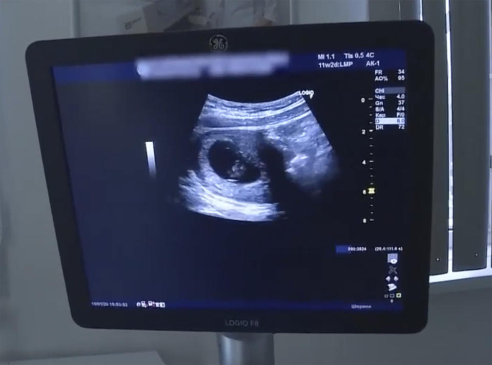 Pictured is Darya's ultrasound. Source: Australscope