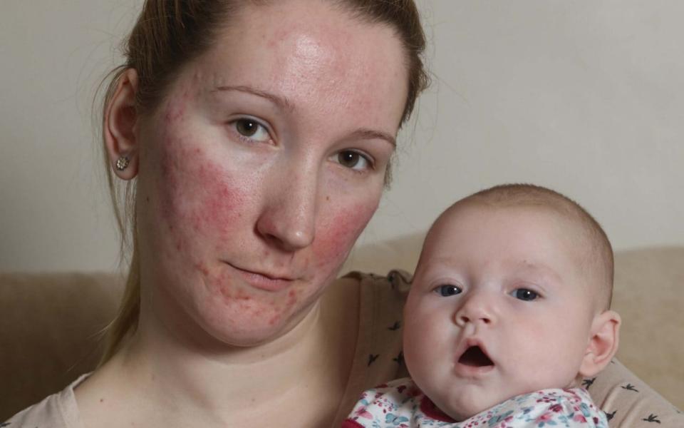 Baby Amelia with her mother Sophie - nb press ltd tel 07976731081