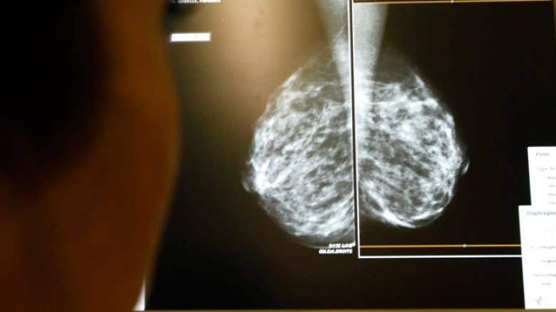 How one group's fight for 'just a line' on a mammogram report could save lives