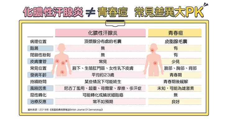 化膿性汗腺炎VS.青春痘差異。（圖片提供／臺灣皮膚科醫學會）