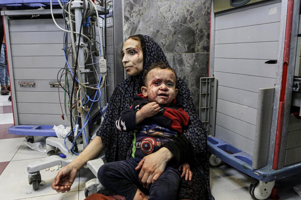 Wounded Palestinians wait for treatment at a hospital in Gaza City on Oct. 17, 2023.