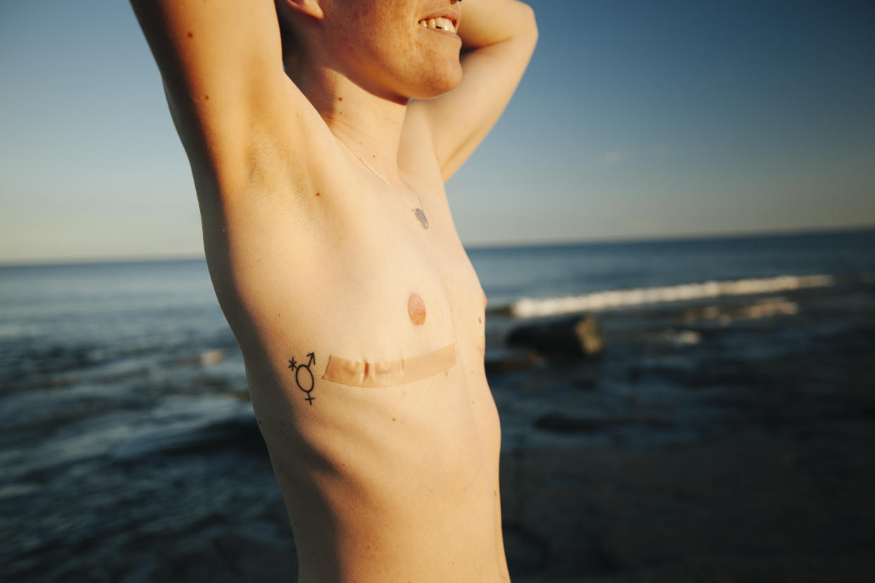 A trans person pictured topless at the beach with top surgery scars clearly visible.