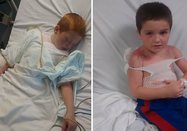 The boys, aged five and seven years old, were taken to hospital after screaming in pain from severe sunburns after a day care excursion, where they were refused sunscreen. Photo: Facebook/shaunna.broadway