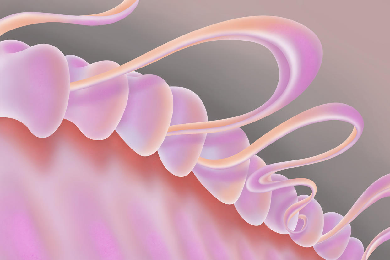 Casi la mitad de los adultos estadounidenses mayores de 30 años muestran indicios de tener gingivitis, la cual puede provocar la pérdida de los dientes. (Hoi Chan/The New York Times)