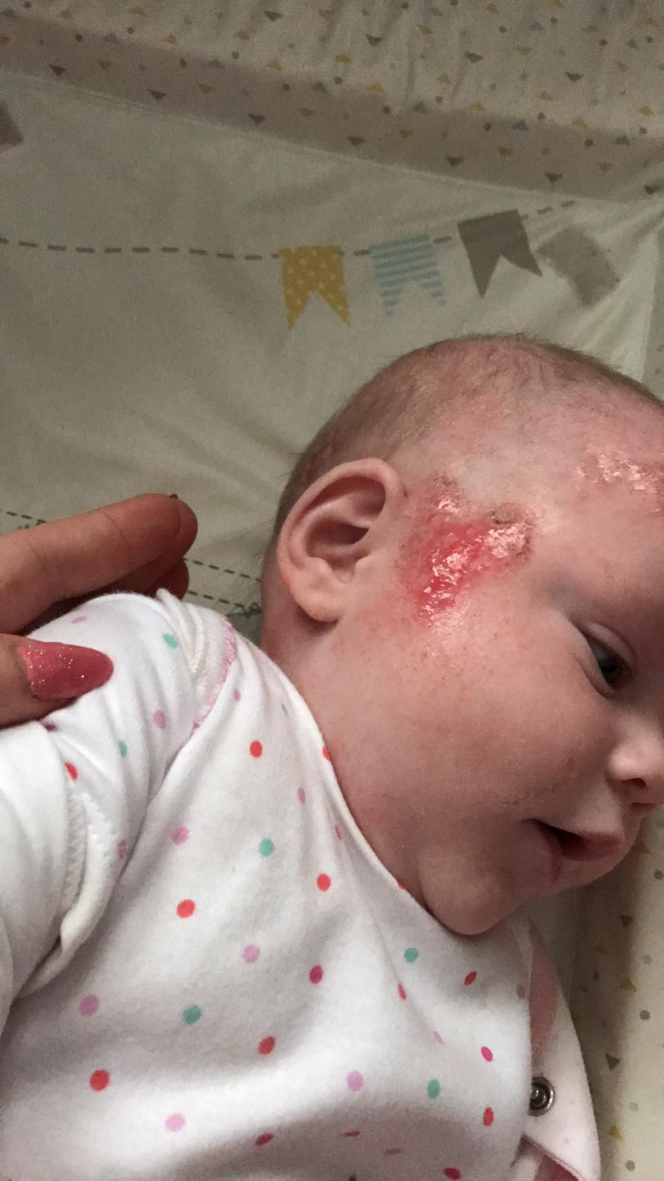 A mum says an over-the-counter moisturiser has cured her baby’s eczema