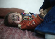 <p>A Syrian baby waits to receive treatment in a makeshift clinic following air strikes in the rebel-held enclave of Arbin in the Eastern Ghouta near Damascus on Feb. 8, 2018.<br> (Photo: Amer Almohibany/AFP/Getty Images) </p>