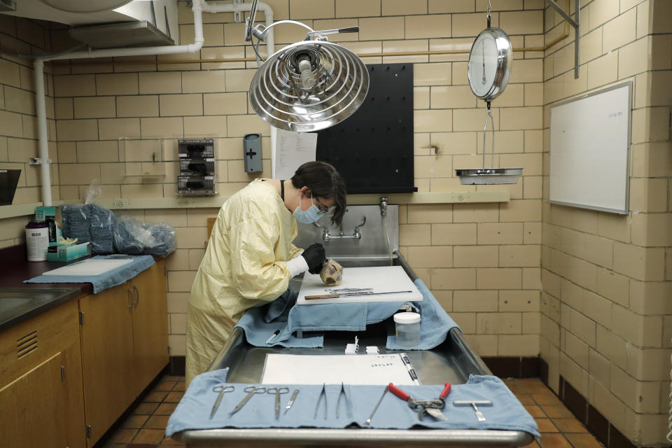 Dr. Desiree Marshall, director of Autopsy and After Death Services for University of Washington Medicine, examines the preserved heart of a person who died of COVID-19 related complications, as she works in a negative-pressure laboratory, Tuesday, July 14, 2020, in Seattle. Seven months after the first patients were hospitalized in China battling an infection doctors had never seen before, countless hours of treatment and research are providing a much closer look at the new coronavirus and the lethal disease it has unleashed. (AP Photo/Ted S. Warren)