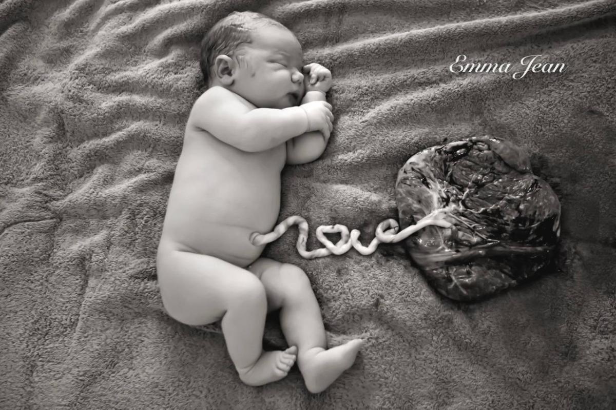 Striking Photo Shows Newborn With Umbilical Cord That Spells 'Love