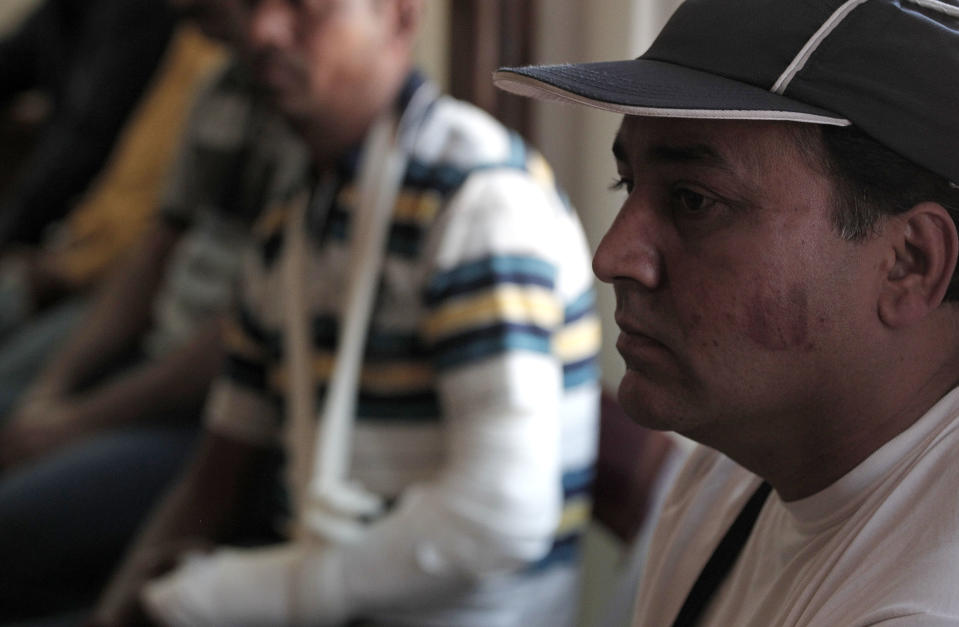 Indian migrant workers Nermal Chand, left and Vije Kumar who were attacked at their home by masked men near Athens, attend a news conference organized by anti-racism campaigners in Athens, Thursday, July 19, 2012. Human rights groups say racially motivated attacks have soared in Greece in recent months. The extreme right Golden Dawn party won 18 seats in parliament in elections last month. It denies direct involvement in the attacks. (AP Photo/Dimitri Messinis)