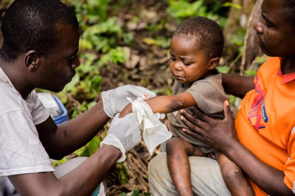 A child affected by monkeypox sits on his father's legs while receiving treatment, during a previous outbreak in the Central African Republic  in 2018 (AFP via Getty Images)